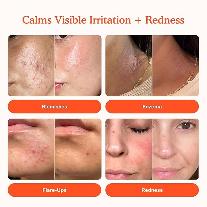 Tower 28 SOS Daily Rescue Spray Duo for Sensitive Skin, Hypochlorous Acid Spray Helps Reduce Redness and Breakouts, Full Size and Travel Size