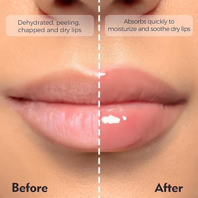 Deep Hydrating Lip Butter Balm | Plump & Nourish with Shea Butter, Vitamin E, Peptides & Hyaluronic Acid | Vegan, Non-Sticky, Anti-Aging Lip Treatment Care | 2-Pack (Clear-Unscented)