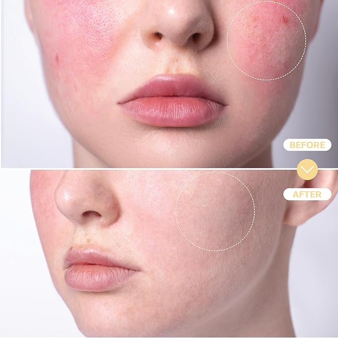 BASE LABORATORIES Hypochlorous Acid Spray for Face & Skin - Travel Size - Facial Toner Spray & Cleaner - Skin Repair Solution helps reduce redness, Irritations, acne - HOCL Molecule Spray 2oz