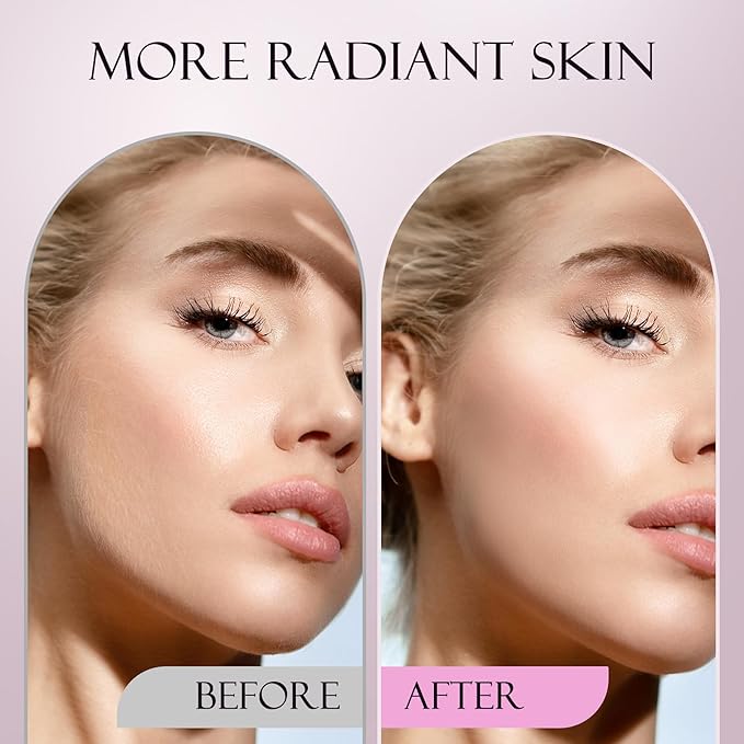 Sonic Dermaplane Razor for Women Face, Dermaplaning Tool for Face, Sonic Edge Technology, Facial Hair Removal for Women, Peach Fuzz with 8 Replaceable Blades(Green)