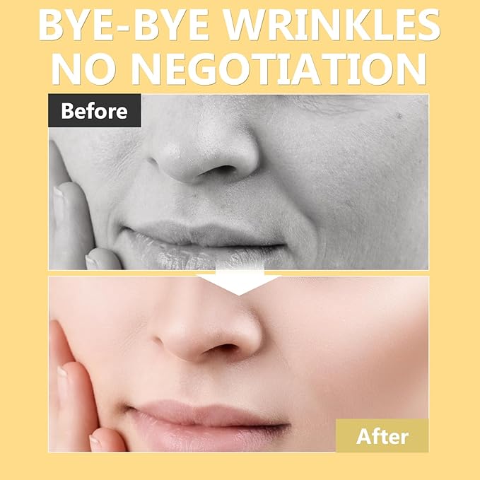 Stem Cell Serum for Face, Advanced Skin Renewal Formula for Wrinkle Reduction, Hydration & Radiance, Professional Ampoule for Daily Use and Microneedling, 1.2 Fl Oz