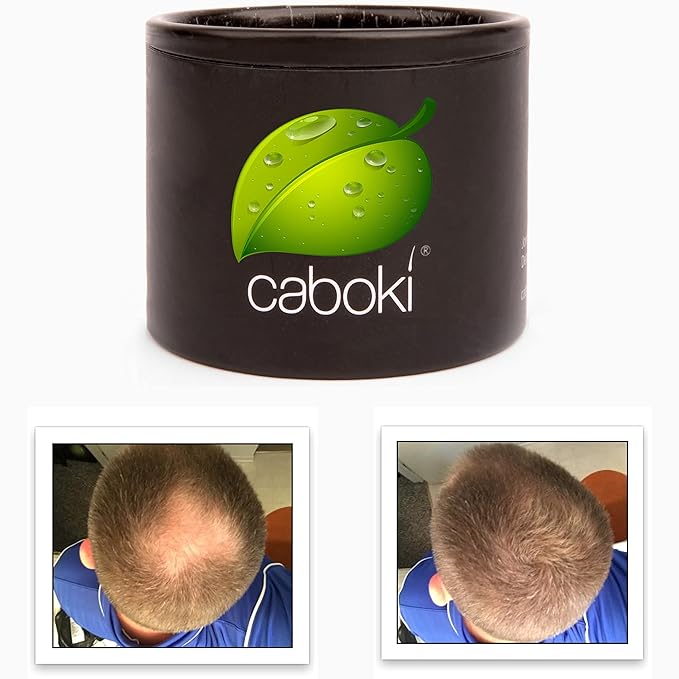 Quick Fix For Thinning Hair and Bald Spot. Get 10X Fuller Hair Instantly. All-Natural Hair Building Fiber For Hair. Trial Size (10-Day Supply). Light Brown