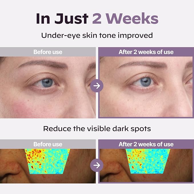 Wrinkle Care Duo : Superform Galvanic Booster Aqua Mint and Glasslike Triple Power Wrinkle Spot Ampoule, 0.47fl. oz