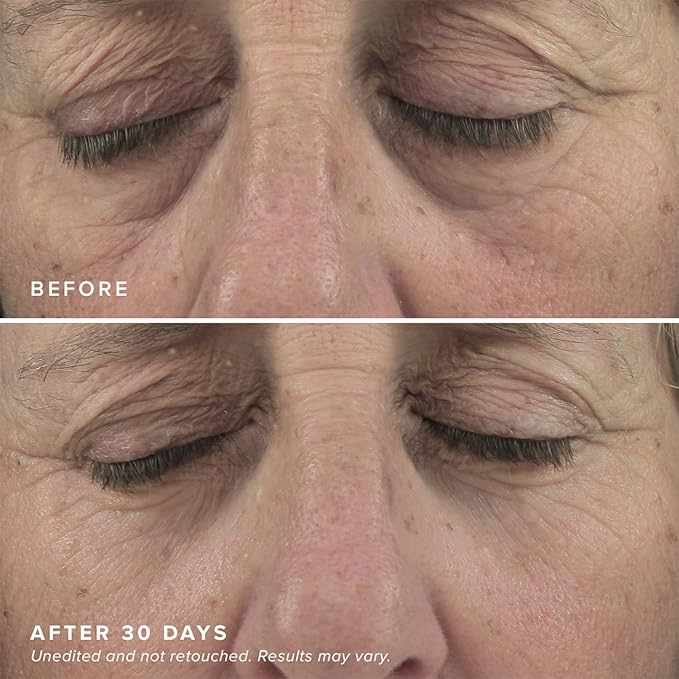 DRMTLGY Brightening Eye Masks (30 Pairs) - Caffeine Eye Masks for Dark Circles and Puffiness with Hyaluronic Acid, Eye Patches for Puffy Eyes - 2 pack