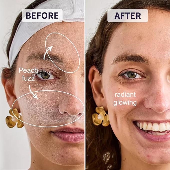 Face Razors for Women, Dermaplane Razor for Women Face, Eyebrow Razor, Dermaplaning Tool, Skin Safe Microblades, Peach Fuzz Remover (9ct, Aegean Frost)