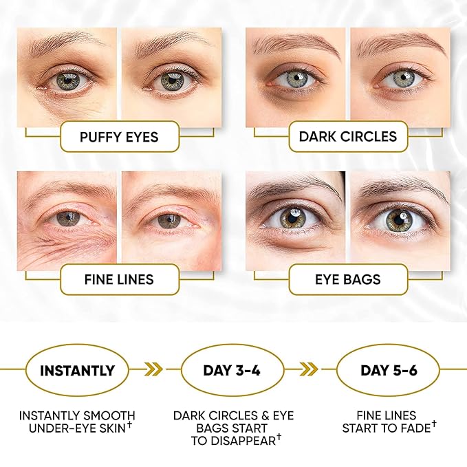 Golden Under Eye Patches for Puffy Eyes & Eye Bags & Wrinkles, Under Eye Patches for Dark Circles,Collagen for Eye Bags, Under Eye Collagen Patches