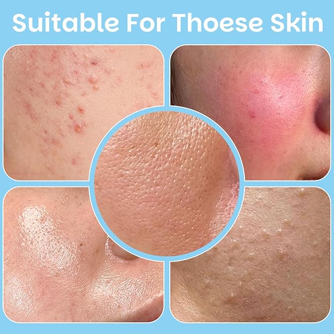 Salicylic Acid Exfoliating Facial Pads for Blemish-Prone Skin |Daily Pore Cleansing & Oil Control | Soothing Skincare Witch Hazel Toner Pads | 70 Count