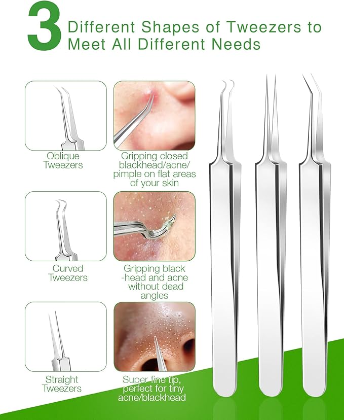 15 PCS Blackhead Remover Pimple Popper Tool Kit,Black Head Removal Extractor for Acne Comedone Whitehead Popping Zit Blemish Facial Skin Care Tools with Metal Case