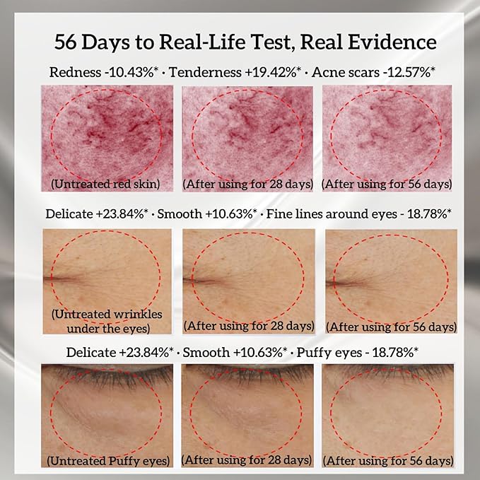 Skin Firming Facial Device, Double Effect 5-in-1Professional Home Beauty Device for Face, Neck, Arms, Abdomen, Legs, 2025 New Upgrade 5 Energy Levels - Salon Results (EP-300)