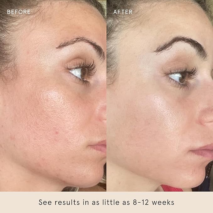 Barefaced Serum Duo - Liquid Gold & Overachiever to Hydrate, Improve Skin Firmness, & Strengthen Skin Barrier