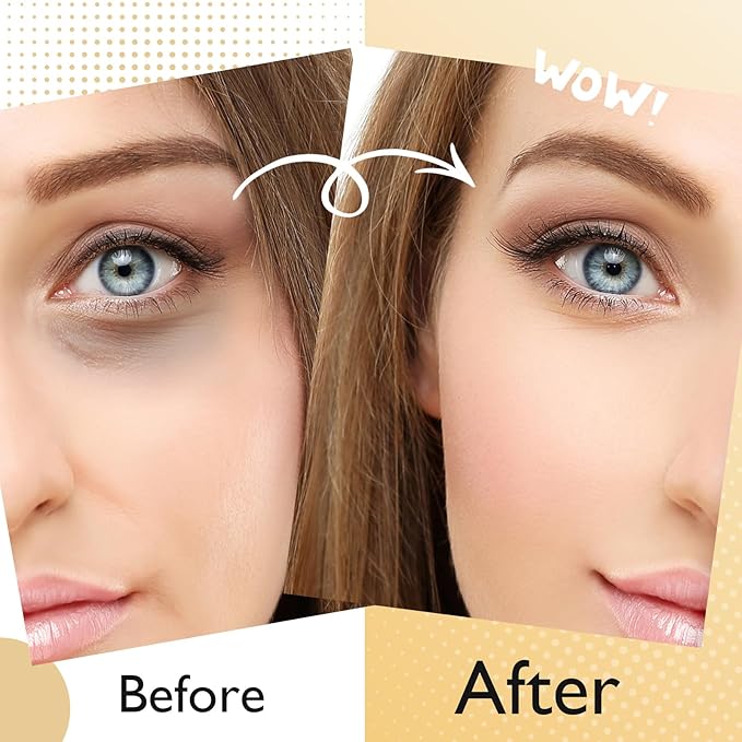 Adofect 25 paris under eye