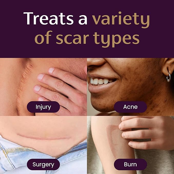 Mederma Scar Cream Plus SPF 30 - Advanced Scar Treatment, Protects from Sun Damage, Reduces Appearance of Scars from Acne, Burns, Surgery & Injury, 0.7 oz