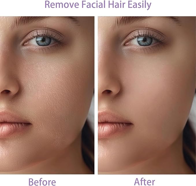 Women Facial Hair Removal Device Battery Operated with 2 Replacement Heads, Painless Womens Face Shaver for Chin Upper Lips Peach Fuzz