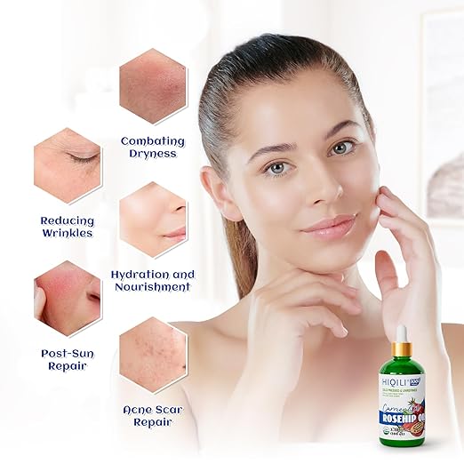 HIQILI 3.38 Fl Oz Organic Rosehip Seed Oil for Face, 100% Pure and Natural, Cold Pressed, Carrier Oil for Skin, Hair & Nails - Women & Men