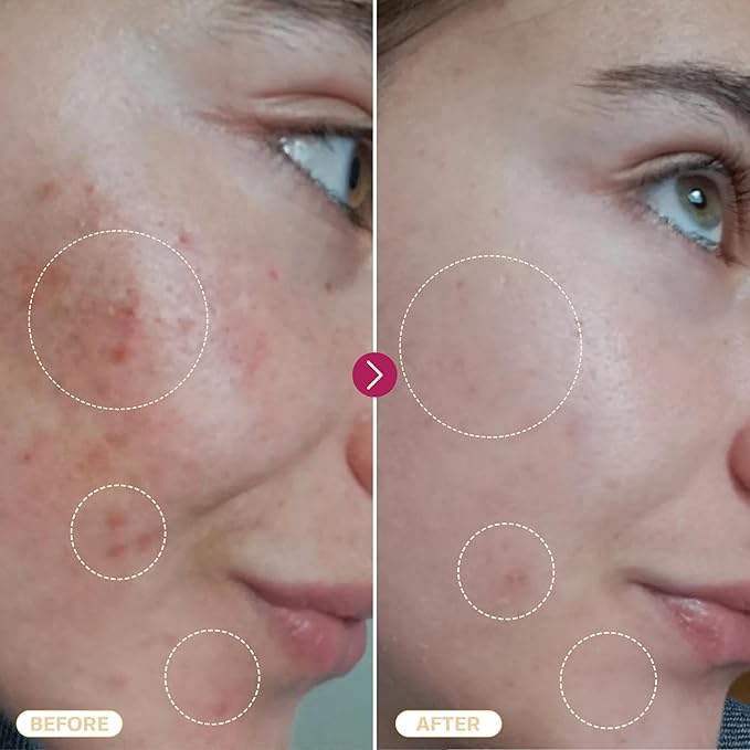 BASE LABORATORIES Hypochlorous Acid Spray for Face & Skin | 8 oz | Facial Spray Daily Skin Repair Solution for Sensitive Skin, Redness, Irritations, Eczema, Acne. Hypochlrous HOCL Molecule Spray