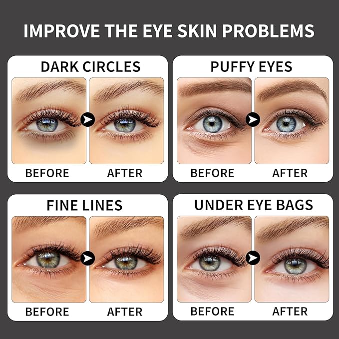 ROUSE 40 Pairs - Caffeine Under Eye Patches Eye Treatment Mask for Dark Circles Eye Fatigue Puffiness Refreshing Revitalizing Skin Care Eye Gel Pads (2 Boxes)