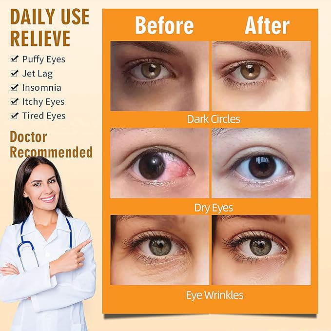 Serfeymi steam eye masks relieve