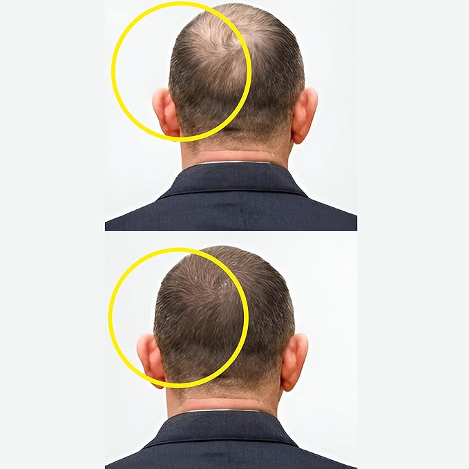 Hair Growth Serum For Density, Hair fall Control with 3% Redensyl, 5% Capixyl, 4% Anagain, 3% Procapil & 3% Baicapil, Rosemary & Biotin For Both Men & Women, 1.01 fl.oz./30ML