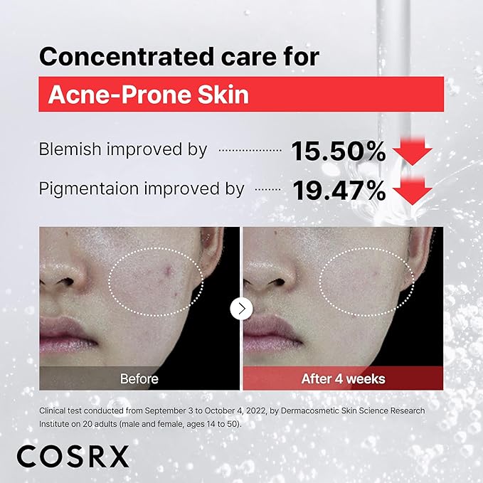 COSRX 15% Niacinamide Face Serum, 0.67 fl oz, Pore Minimizer Serum for Face, Even Skin Tone, Korean Skin Care, Stocking Stuffers, Gifts For Women