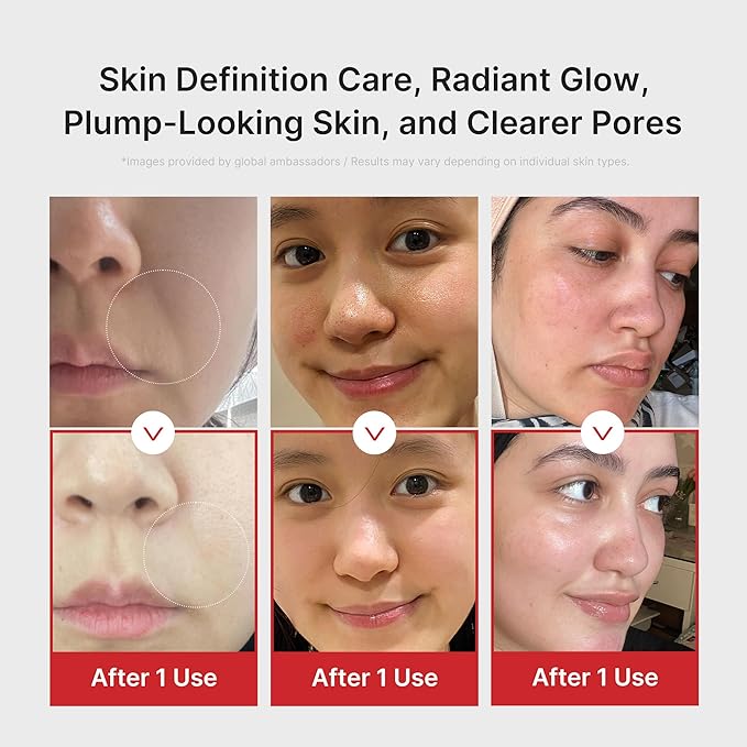 medicube Age-R Booster Pro Pink | 6-in-1 Real Glass Glow Beauty Massager | Looking Glass Skin | Korean Skin Care