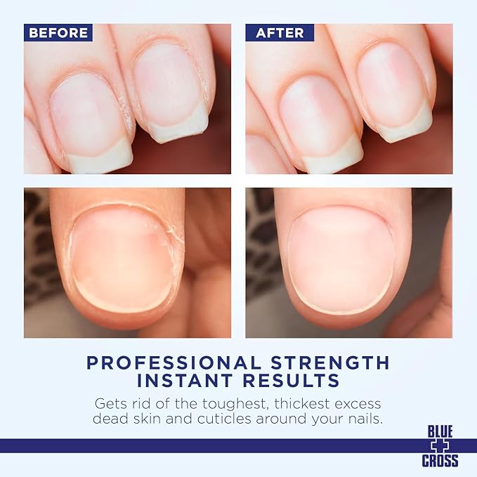 Blue Cross Professional Nail Care,