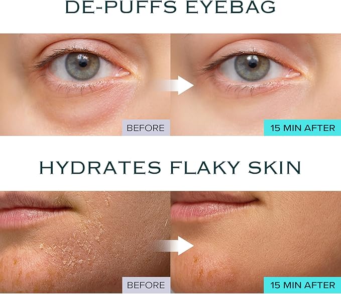 Ice Sorbet Toner Pads | Skin Prep Wipes for Puffiness, Under Eye Bags & Instant Face Lift | Gel Pads for Sunburn Relief & After Sun with 30% Glacial Water & Caffeine | Pack of 2 (120 Count)