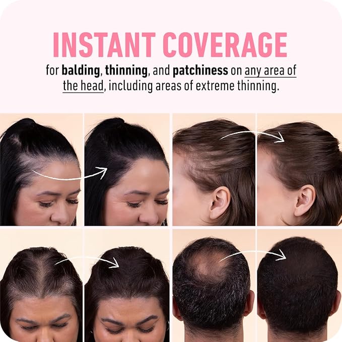 BOLDIFY Hairline Powder (LARGE, 10g) - Root Touch Up Hair Color for Gray Coverage - Bald Spot Concealing Hair Powder for Women & Men - 24-Hour Stain-Proof - Hazel Brown