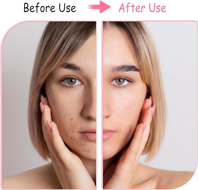 2Pcs Silicone Face Brush Manual Face Scrub Brush, Soft Facial Cleansing Brush Waterproof Exfoliating Face Brush Skin Friendly Face Cleaner Brush for Blackheads Makeup Residues Removal