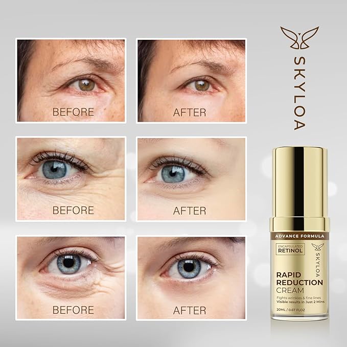 Retinol Eye Cream Anti Aging: Under Eye Cream for Dark Circles and Puffiness Bags - Retinol Eye Serum - Under Eye Serum with Caffeine and Hyaluronic Acid - Visibly Reduces Wrinkles Fine Lines(20ML)