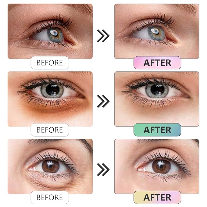 Under Eye Patches -30 Pairs Sakura Essence Eye Mask for Puffy Eyes,Reducing Dark Circles,Anti-Aging & Refreshing, Collagen Eye Mask for Moisturizing,Sakura Pink