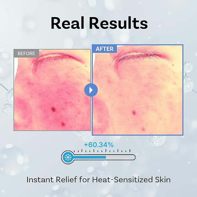 APOTHE Exosome Squal-Tox 3% Ampoule 1.01 fl oz (30ml) – Intense Hydration, Skin Renewal, Brightening & Anti-Wrinkle Care with Exosome Technology and Niacinamide