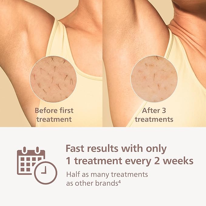 Philips Lumea 8000 Series IPL Hair Removal Device - Alternative to Laser Hair Removal, SenseIQ Technology and Lumea App, 2 Attachments for Body & Face, for Women & Men, BRI932/03