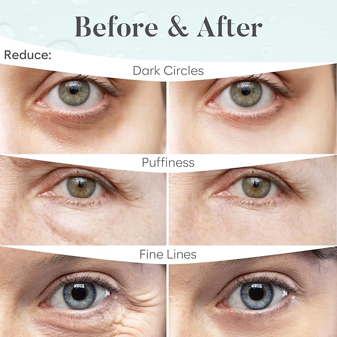 Hyaluronic acid eye patches (30