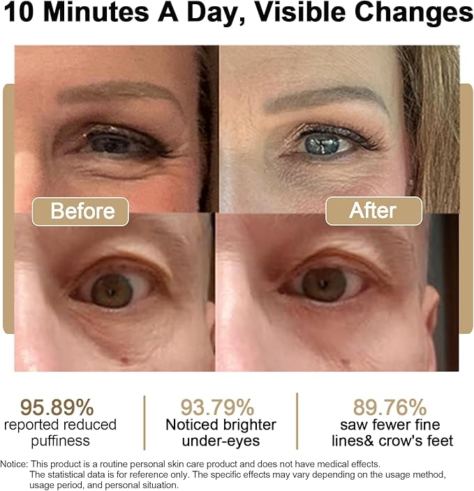 Under Eye Red Light Therapy Glasses Micro Vibration Eyelift Device Red Light Therapy for Relieve undereye Bags Fatigue Dark Circles Wrinkles Puffiness for Women and Men