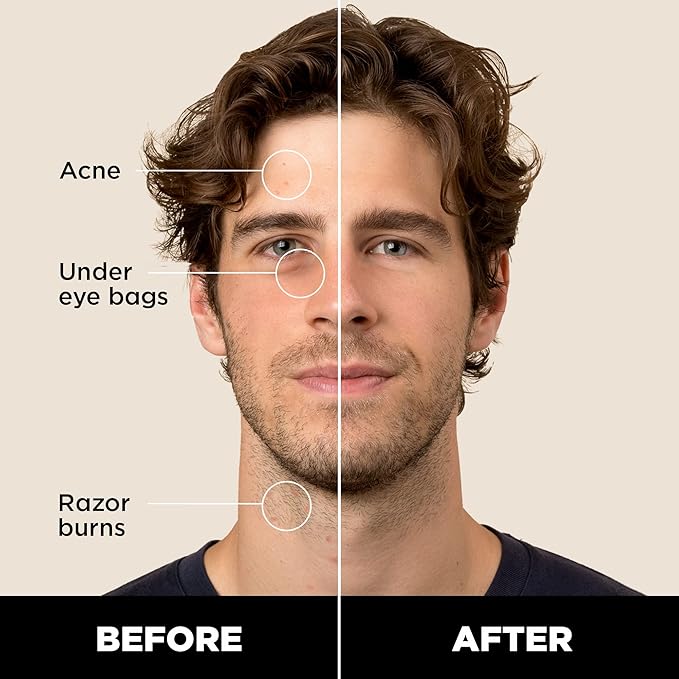 Stryx Concealer Stick Tool for Men, Light Cognac - Natural Pigments Hides Imperfections, Acne, Razor Burns, Scars, & Rosacea - Highly Adaptable Shades for Easy, Undetectable Coverage - All Skin Tones