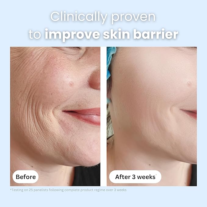 Manuka Honey 45+ MGO & Bee Venom Day Cream | 100% Natural Firming Anti-Wrinkle Face Moisturizer with Hyaluronic Acid & Vitamin C | 2oz