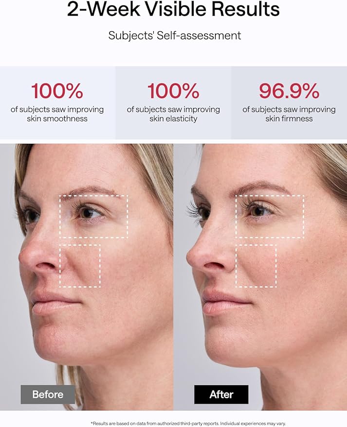 JMOON Microcurrent Facial Device, M30U Red Light Therapy for Face, Safe Anti Aging Skin Care, 4 Modes, 5 Energy Levels for Full Face Lift and Ideal for Smile Lines, Eyes, and Forehead (Pink)