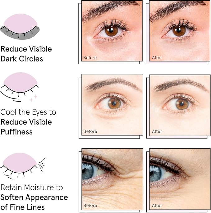 grace & stella Under Eye Patches (12 pairs) Eye Masks for Puffy Eyes and Dark Circles - Birthday Gifts for Women, Bachelorette Party Favors, Bridesmaid, Self Care and Relaxation Gifts for Her - Vegan