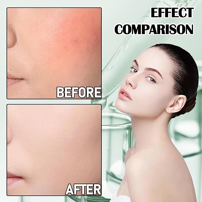 8Pcs Organic Aloe Vera Gel for After Sun Skin Care,Natural Moisturizing Aloe Vera Gel for Face & Body,Easy to Portable Face Moisturizer,Travel Size Pure Vera Aloe Gel for all Skin Types J