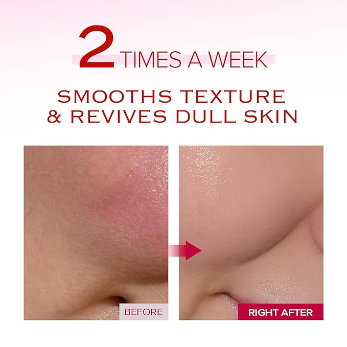 Very Berry Wash Off Pack | Korean Sauna Face Mask | Berry Complex + Fermented Ingredients for Skin Barrier | Instant Glow Up Effect | Whipped Cream Pack for Textured, Dry Skin 3.38 FL OZ