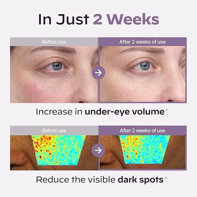 Superform Galvanic Booster Aqua Mint, 1min booster for ageless skin, anti-aging and firming pocket booster, glow on the go, Korean skincare, Gifts, Stocking Stuffers for Women