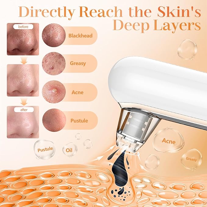 Yccu Blackhead Remover Vacuum Pore Extractor Black Head Remover for Face&Nose Blackhead Extractor Pore Vacuum Pimple Extractor Tool Pore Cleaner with USB Charge 4 Modes 5 Suction Heads for Women&Men