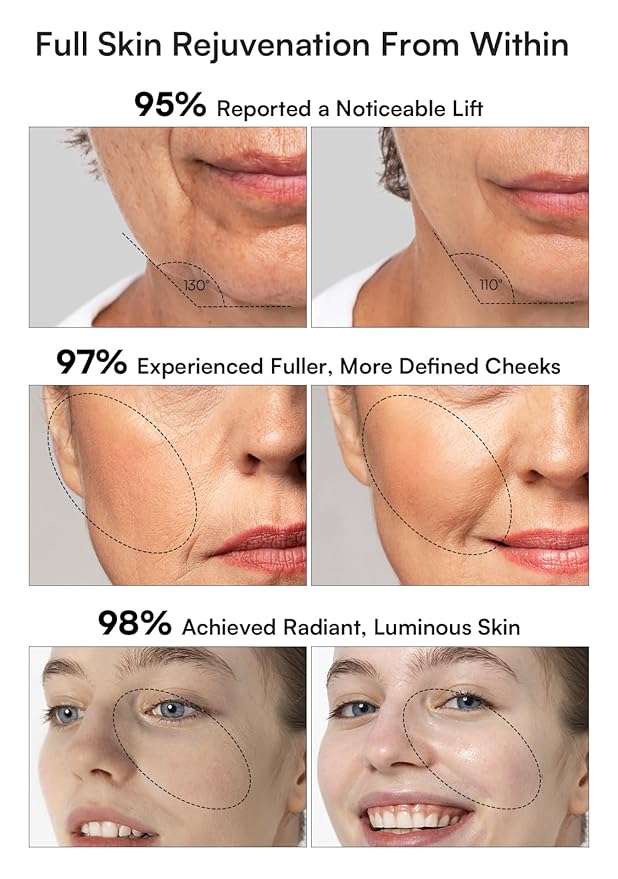 INIA Flare Facial & Body Beauty Device