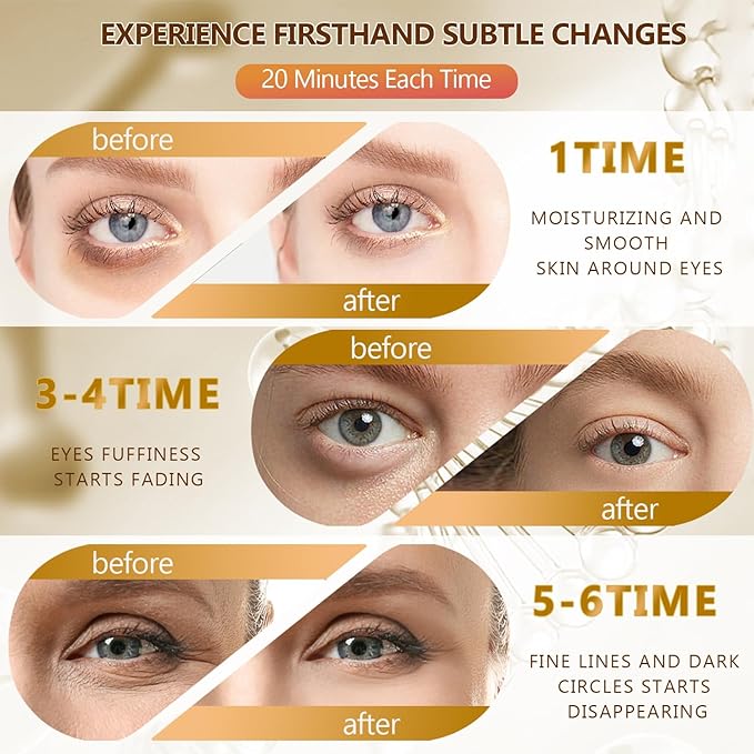 2 Packs 60 Pcs Under Eye Patches, 24K Gold+Pink, 30 Pairs Undereye Mask for Puffy Eyes Dark Circles Treatment, Collagen Gel Pads Hydrating for Eye Bags Puffiness Wrinkle, Women Men Beauty Skin Care