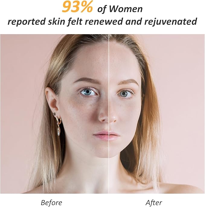 Skin Firming Facial Device, Double Effect 5-in-1Professional Home Beauty Device for Face, Neck, Arms, Abdomen, Legs, 2025 New Upgrade 5 Energy Levels - Salon Results (EP-300)