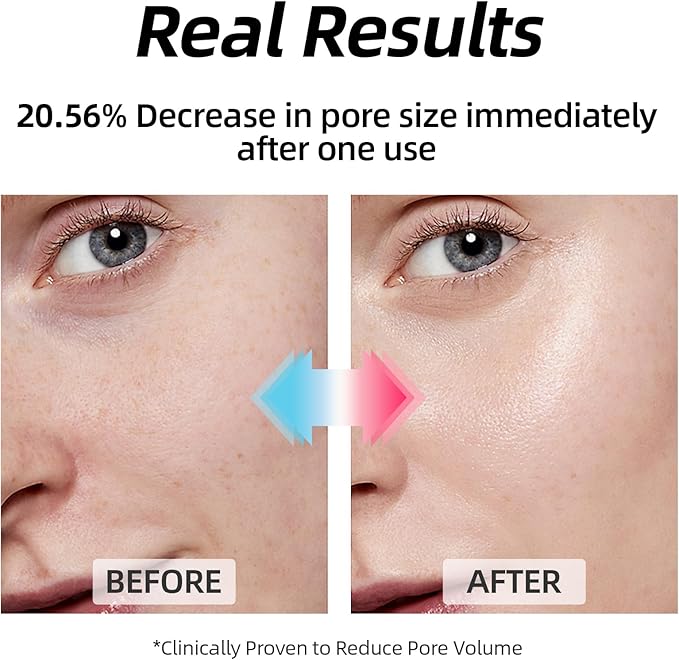 MEDB Hydracalm Toner Pads - 60 Counts Exfoliating Face Pads with BHA & PHA for Acne & Breakouts, 40% Centella Asiatica for Sensitive Skin, Hydrating, Alcohol-Free, Korean Skin Care