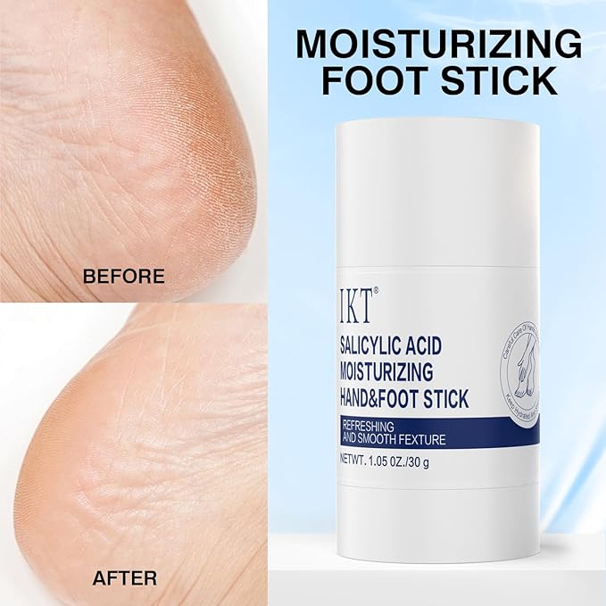 Foot Cream Stick for Dry Cracked Heels,Moisturizing Balm with Olive Oil,Roll-On Repair Treatment for Rough Feet, Hands & Elbows,No Mess Foot Lotion Alternative,1.05 oz,1 pack