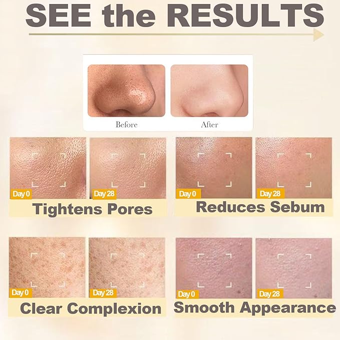 100ML Black Rice Peeling Glow Ampoule, Gentle Rice Exfoliating Face and Body Scrub for Removing Sebum, Dead Skin Cells, Black Pore Deep Cleaning, Fit for All Skin Types