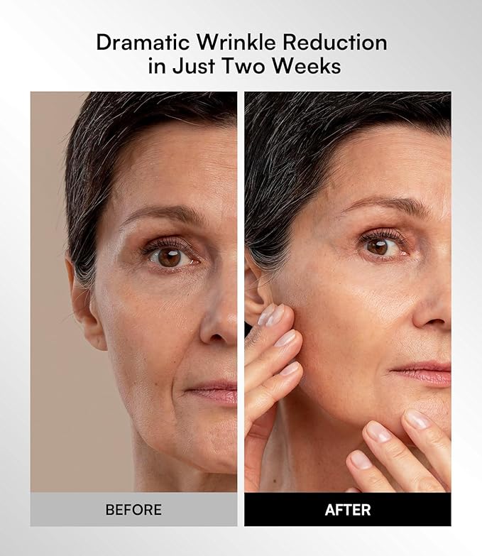 INIA Red Light Therapy Mask for Face, Glow Wireless LED Face Mask Light Therapy with Near-Infrared Red Light (NIR), Rechargeable and Ergonomic Design for Home & Travel