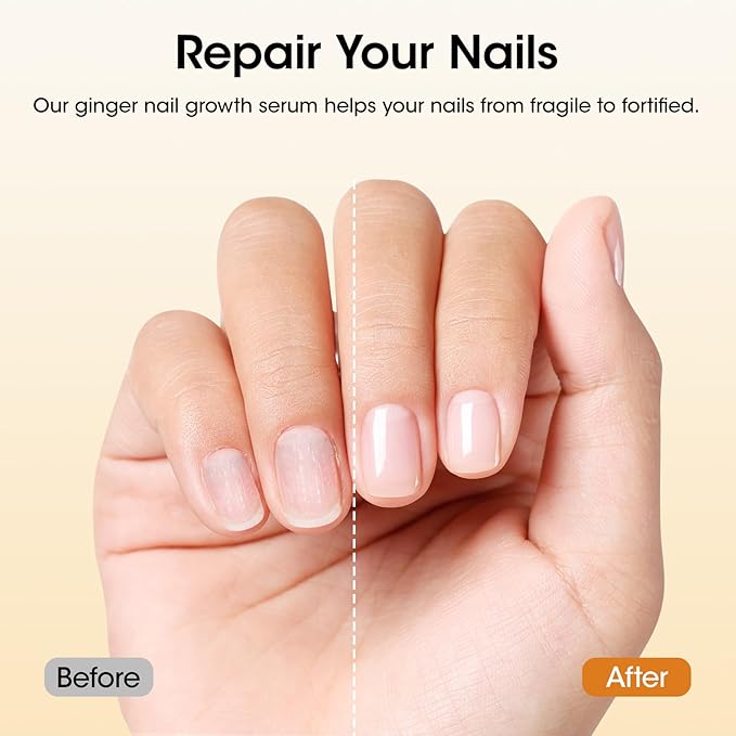 Gellen 30ml Ginger Nail Growth Serum for Nail Strengthener and Growth, Nail Repair Treatment for Weak Brittle Splitting Damaged Nails, Hydrated & Nourished Nail Care Solution for Hands & Feet